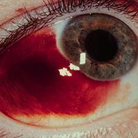 恐怖重口味头像想你网 如果有一天你有勇气